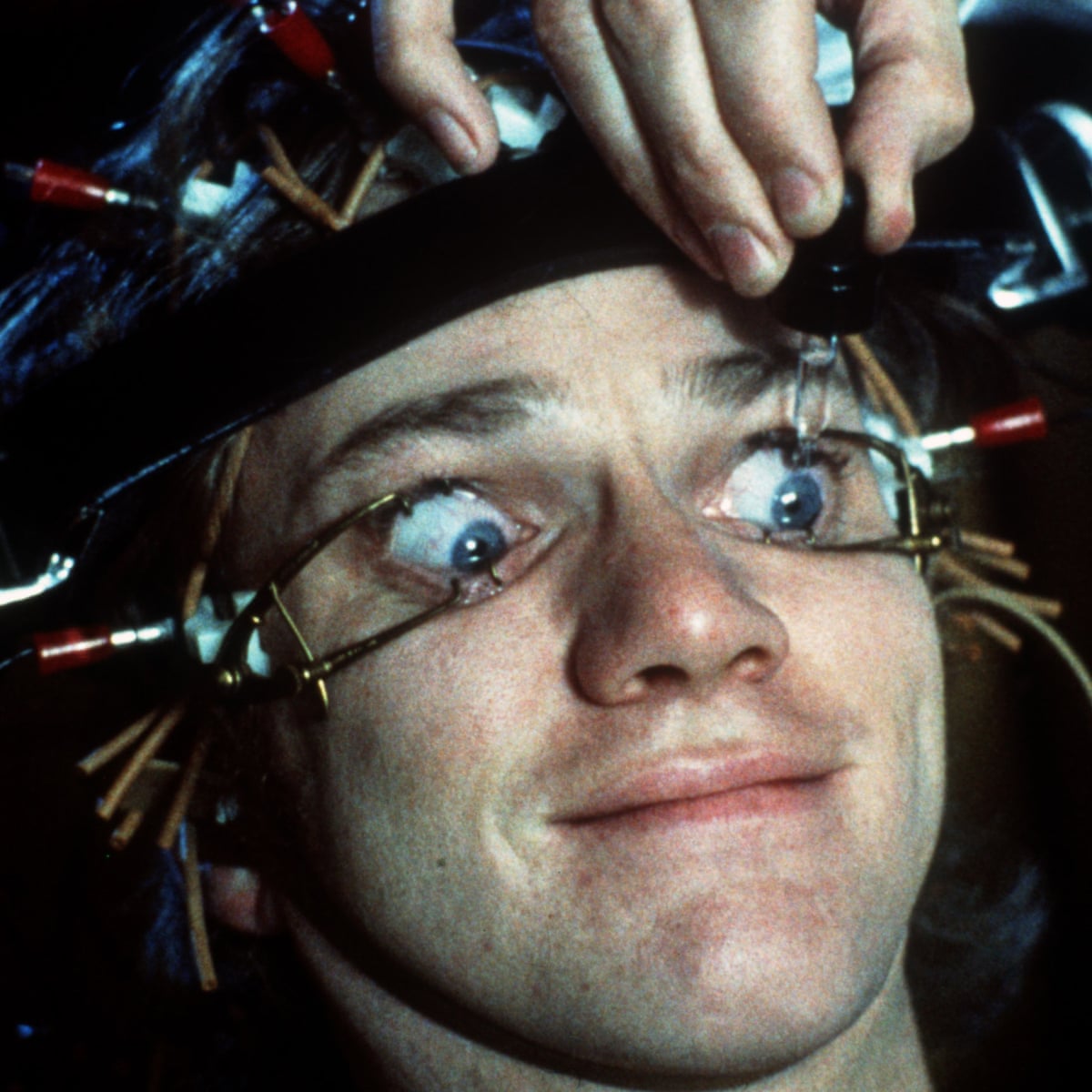eye surgery
