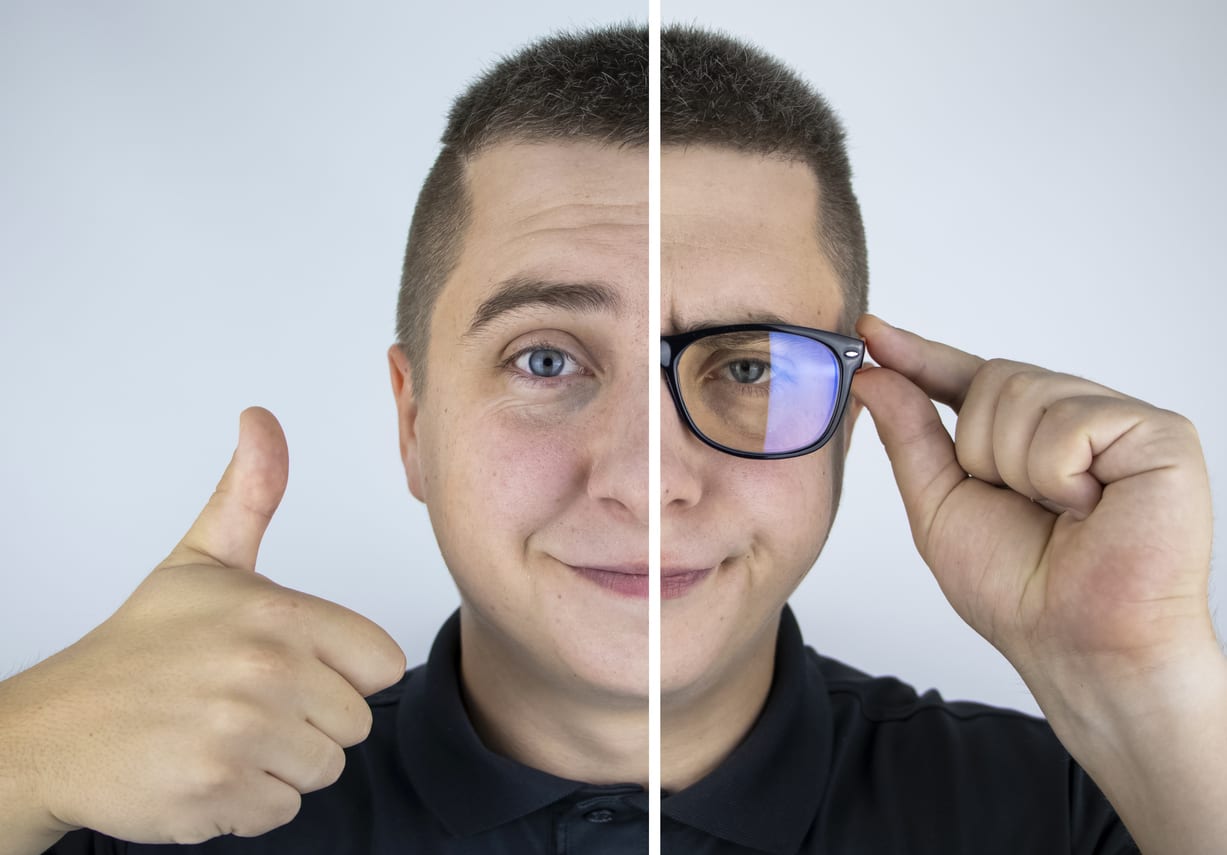 lasik surgery