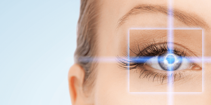 lasik surgery