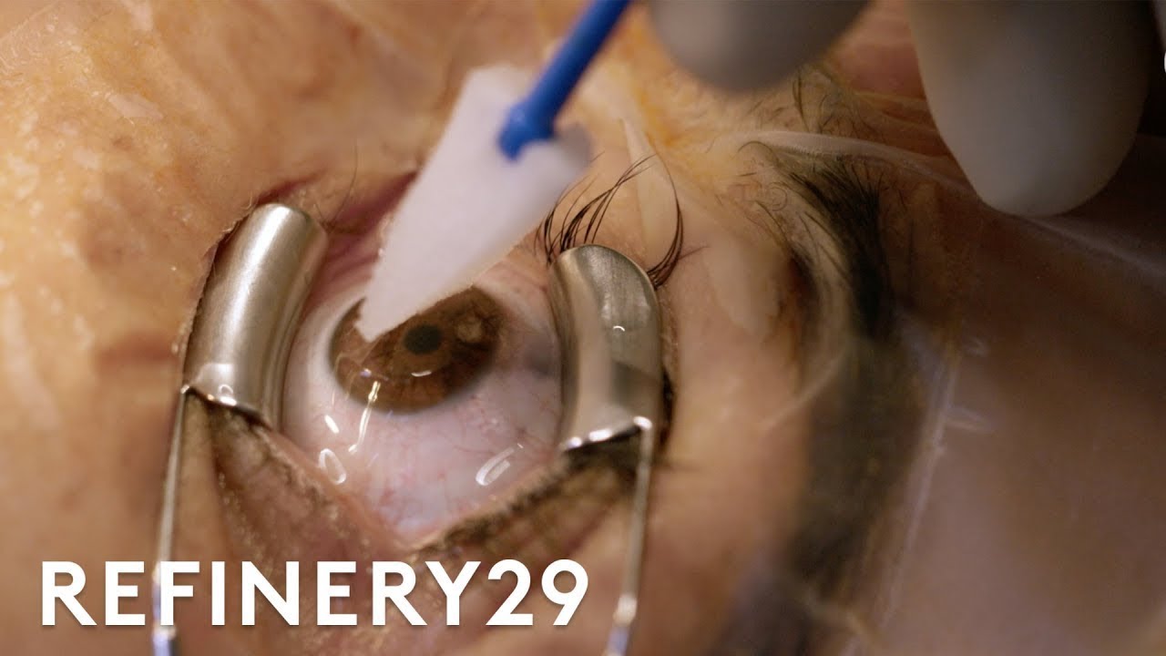 eye surgery