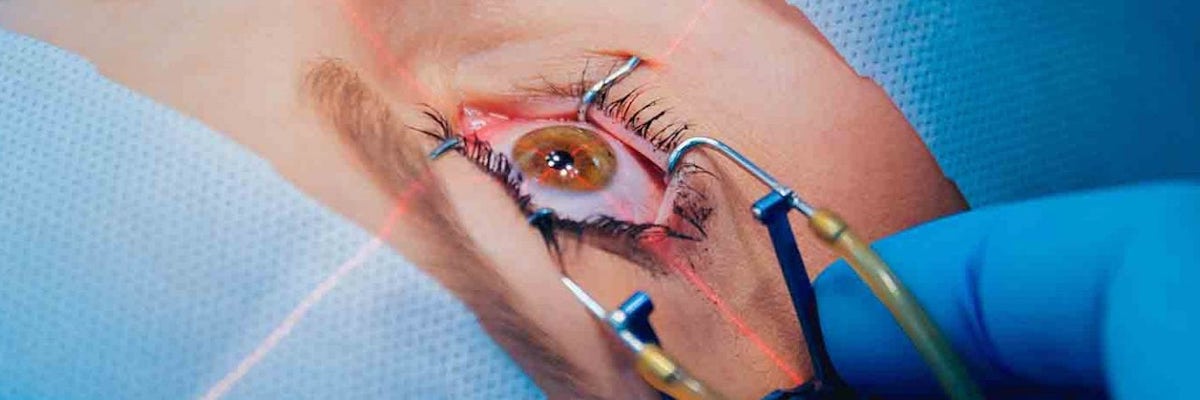 eye surgery