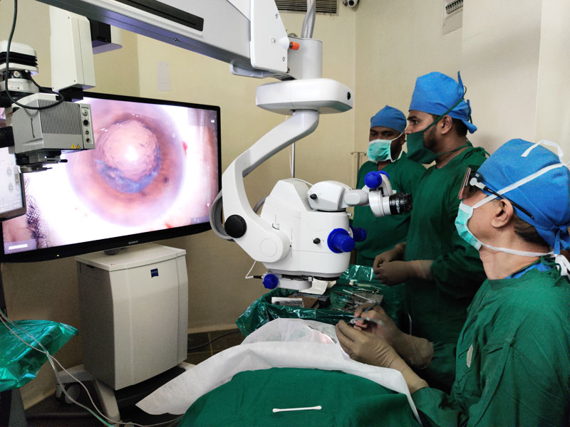 eye surgery