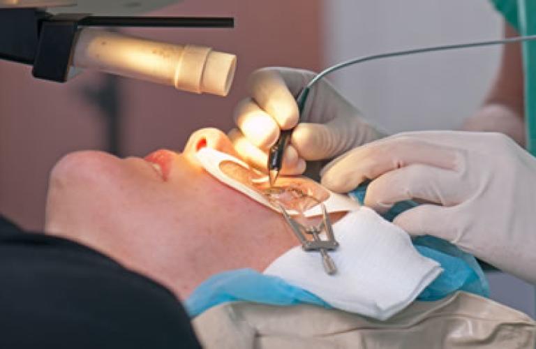 eye surgery